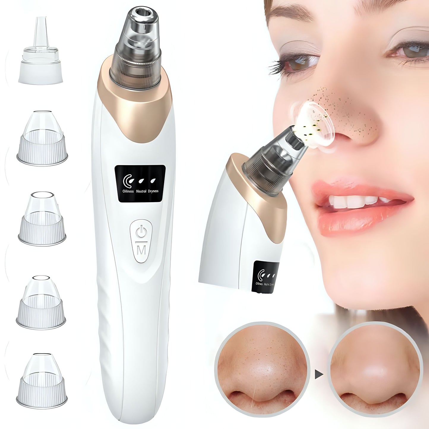 TAG more™ Derma Suction Rechargeable Blackhead Remover | 5 Suction Levels Pore Vacuum Cleaner - TAG more